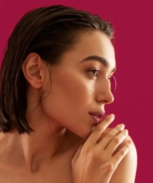 Rhinoplasty Before & After