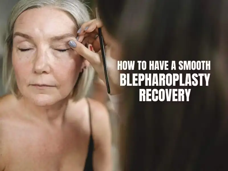 Blepharoplasty recovery timeline