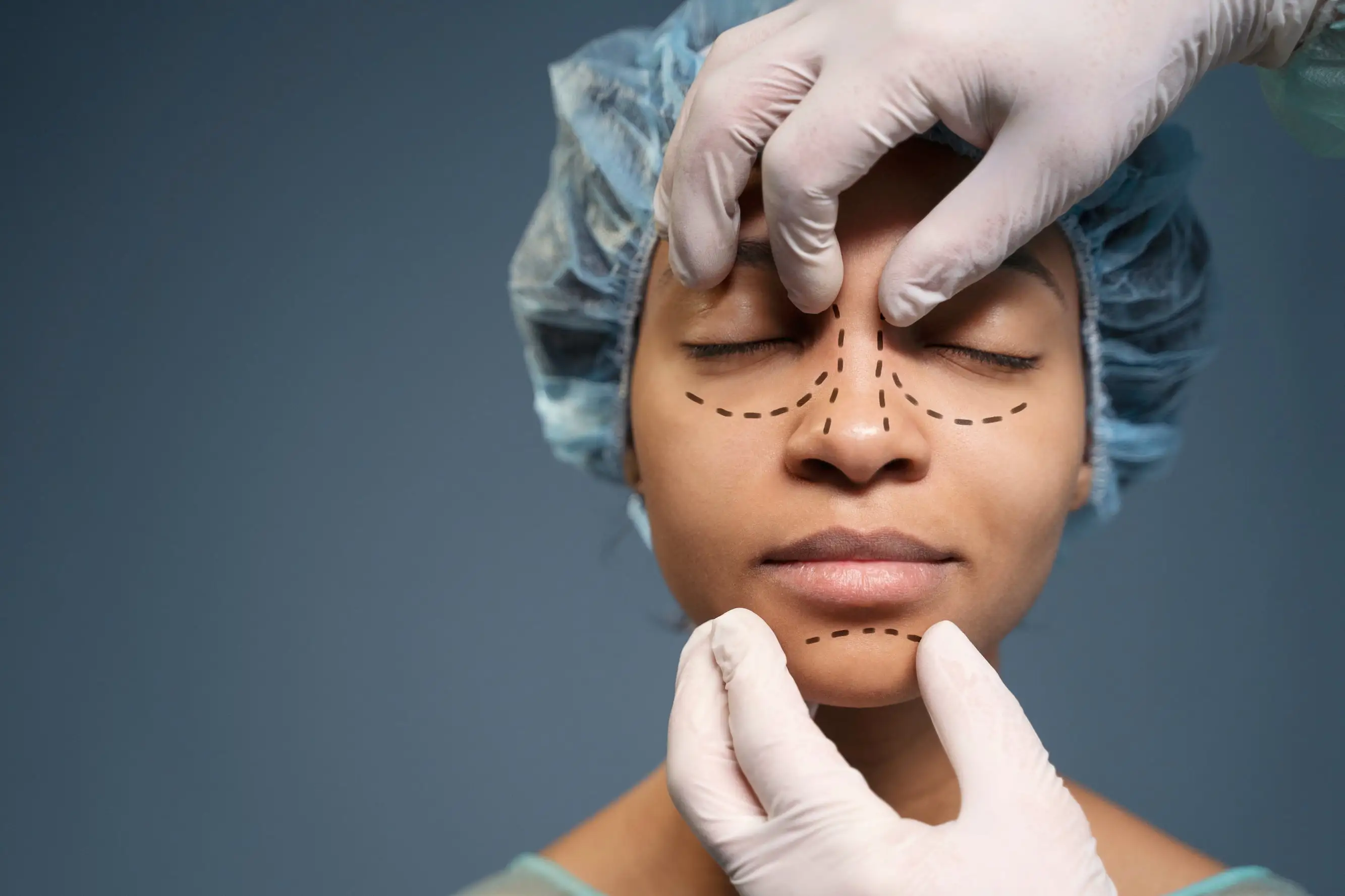 Rhinoplasty Recovery Tips