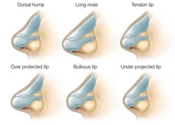 Patient Relaxing in Hotel During Recovery