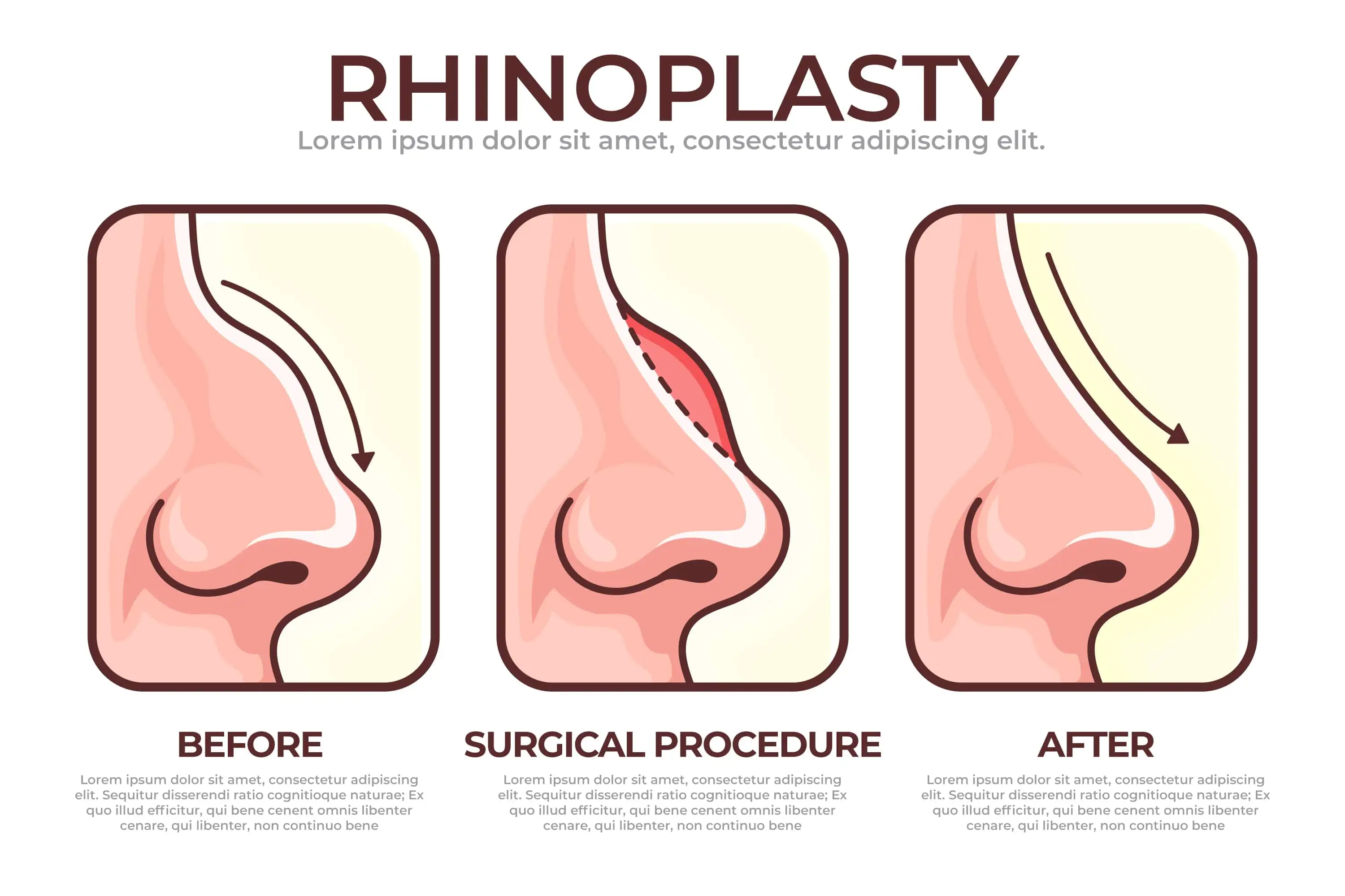 Patient Relaxing in Hotel During Recovery