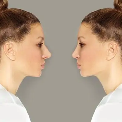 Receptionist Assisting International Patient