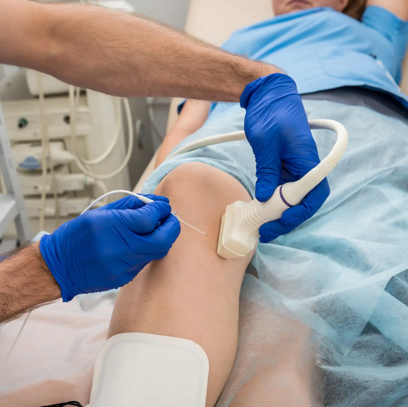 Varicose Veins Diagnosis