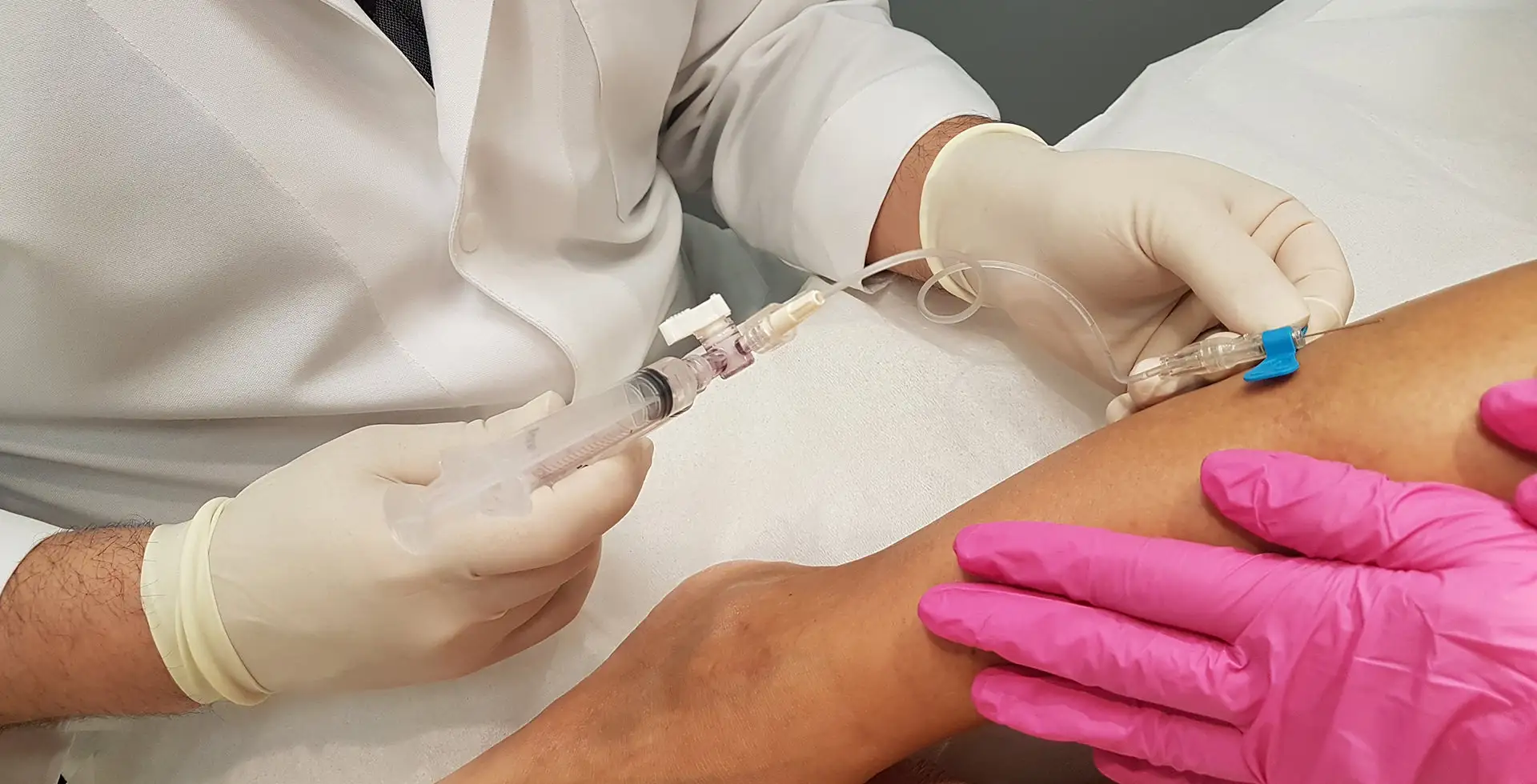 Varicose Veins Diagnosis