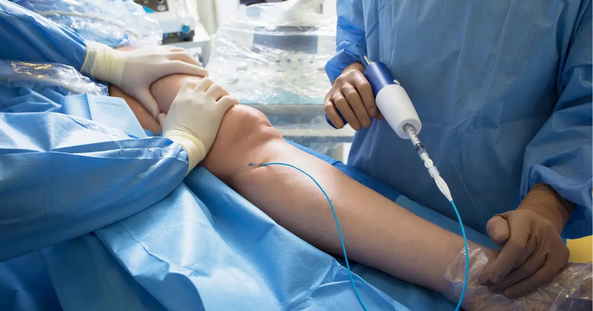 Varicose Veins Diagnosis