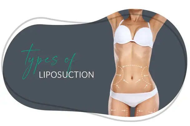 Ultrasound-Assisted Liposuction